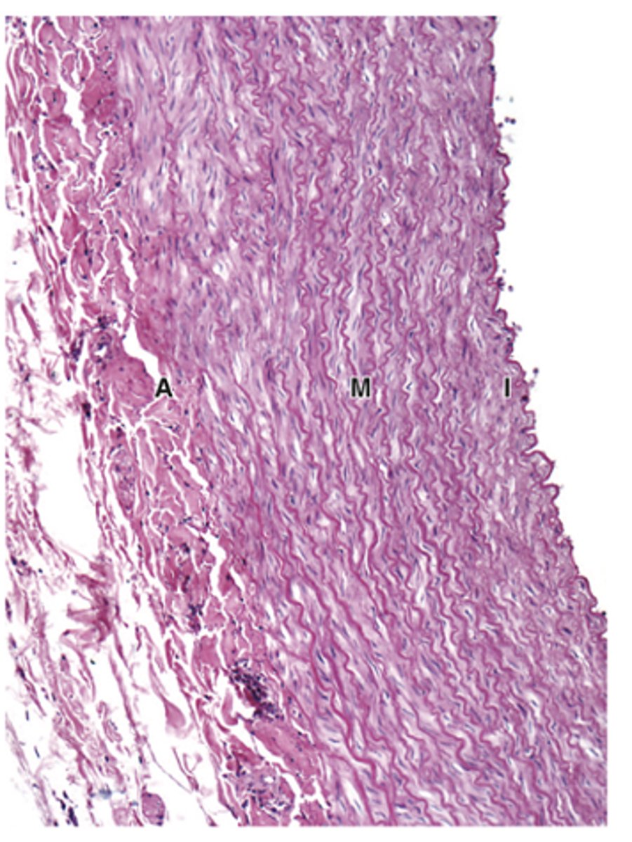 <p>How is the tunica media of elastic arteries structured?</p>