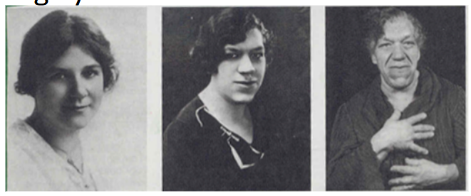 <p>Too much growth hormone from the pituitary</p>