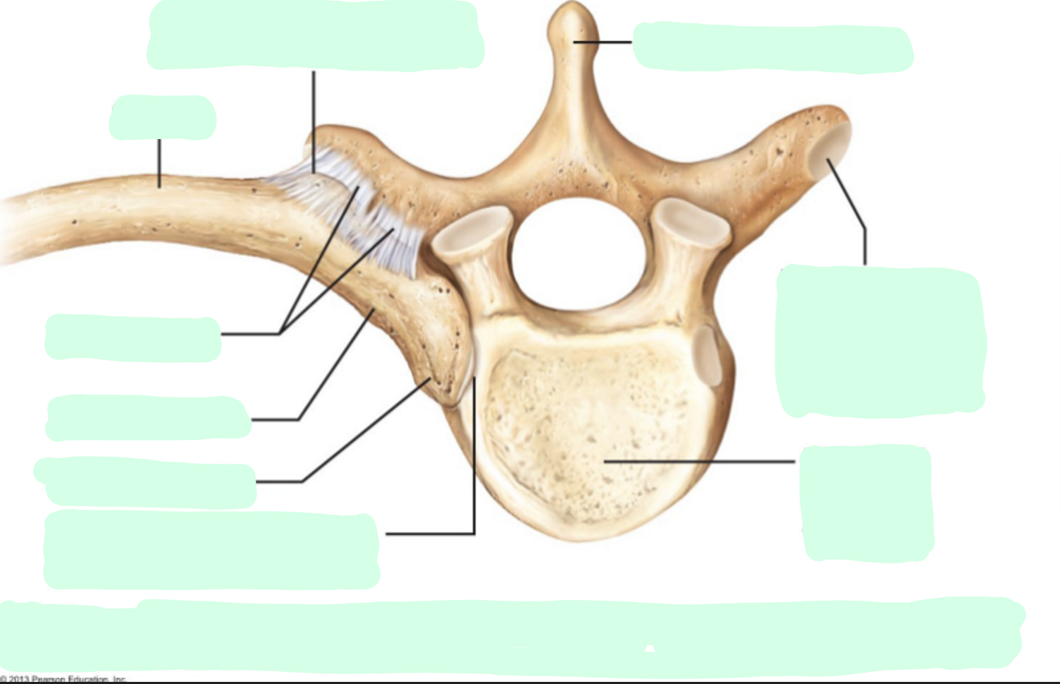 <p>Where is the<strong> Superior costal facet </strong>for the tubercle of ribs of the thoracic vertebra?</p>