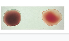 contains no antigen 