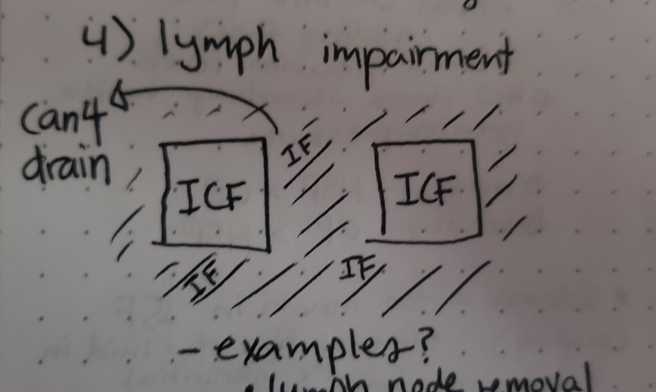 <p>Increased plasma HSP, decreased plasma OP, increased capillary permeability, impaired lymph drainage.</p>