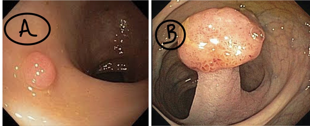 <p>A- identify</p><p>B- describe</p><p>C- originate from ?</p>