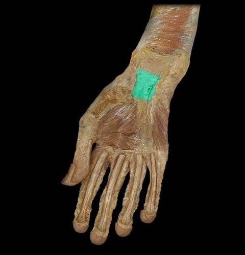 <p>Essentially the wrist, with all of the nerves and tendons</p>