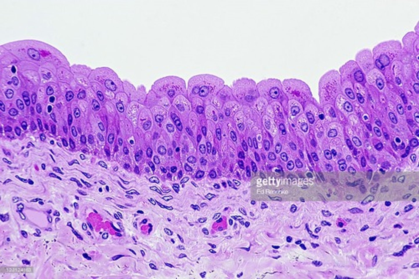 <p>Nucleus</p><p>Plasma membrane</p><p>Cytoplasm</p><p>Bladder</p>