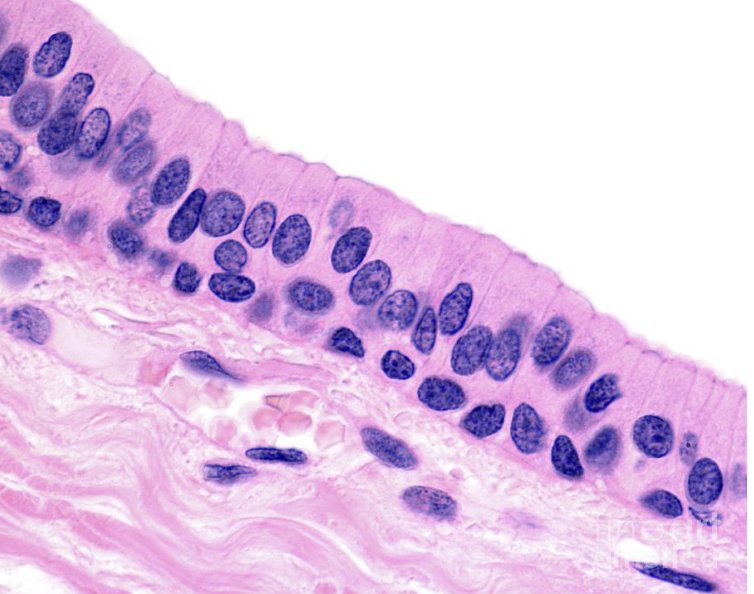 <p>what tissue is this&nbsp;</p>