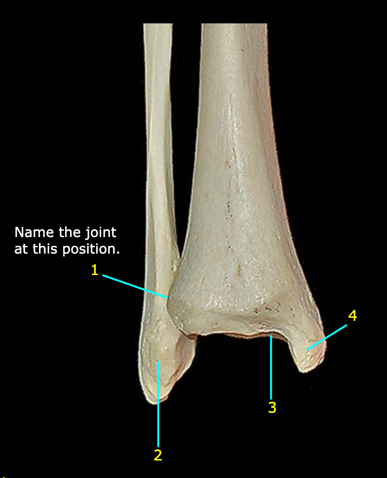 <p>What structure is labeled 1?</p>