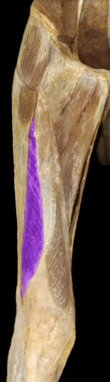 <p>Name the muscle highlighted (two words - all lowercase)</p>