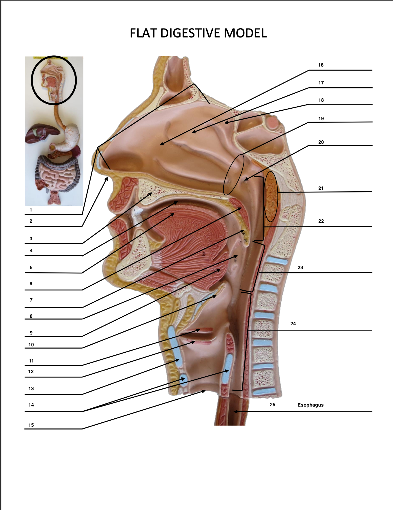 <p>Esophagus</p>