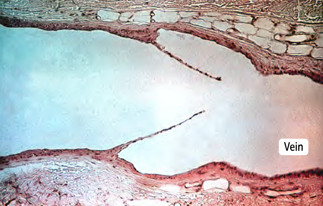 <p>Veins</p><ul><li><p>Histologically very similar to venules</p></li><li><p>Have one-way valves that maintain unidirectional flow. These valves are formed by outpouchings of the tunica intima into the venous lumen</p></li></ul><p></p>