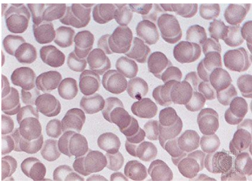 <p>what are the abundant cells?</p>