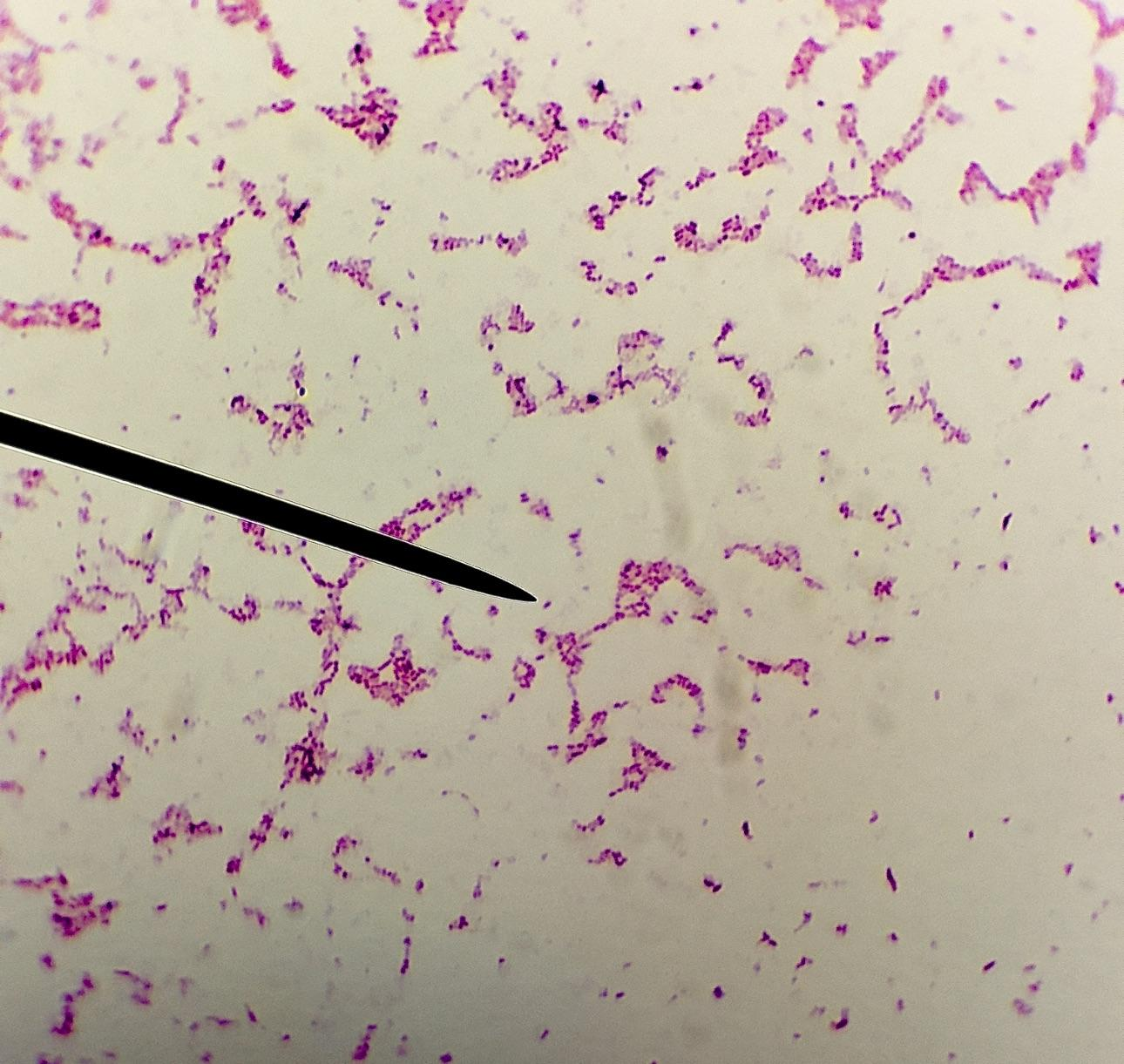 <p><em>Serratia marcescens</em></p><ul><li><p>Rod-shaped (bacilli)</p></li><li><p>typically singles or in pair or short chains</p></li><li><p>1.0 to 2.0 micrometers</p></li><li><p>pink or red (Gram-negative)</p></li><li><p>opportunistic human pathogen in hospitals and as a plant growth promoting bacteria (PGPR) in crops</p></li></ul><p></p>