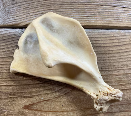 <p>trapezius tubercle is prominent and overhangs infraspinous fossa</p>