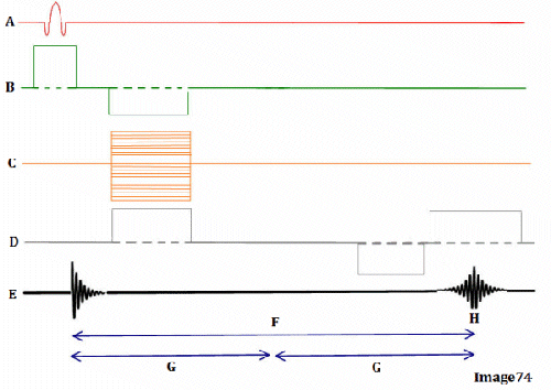 <p><span><strong>Letter H in Image 74 represents:</strong></span></p>