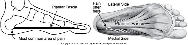 <p>What footwear is recommended for Plantar Fasciitis prevention/management?</p>