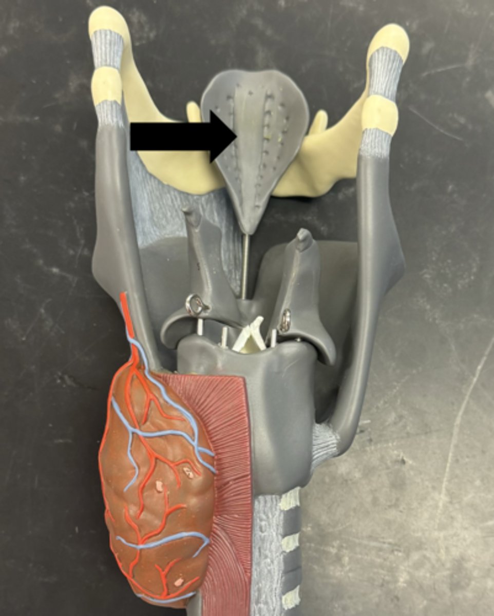 <p>name the structure &amp; type of cartilage</p>
