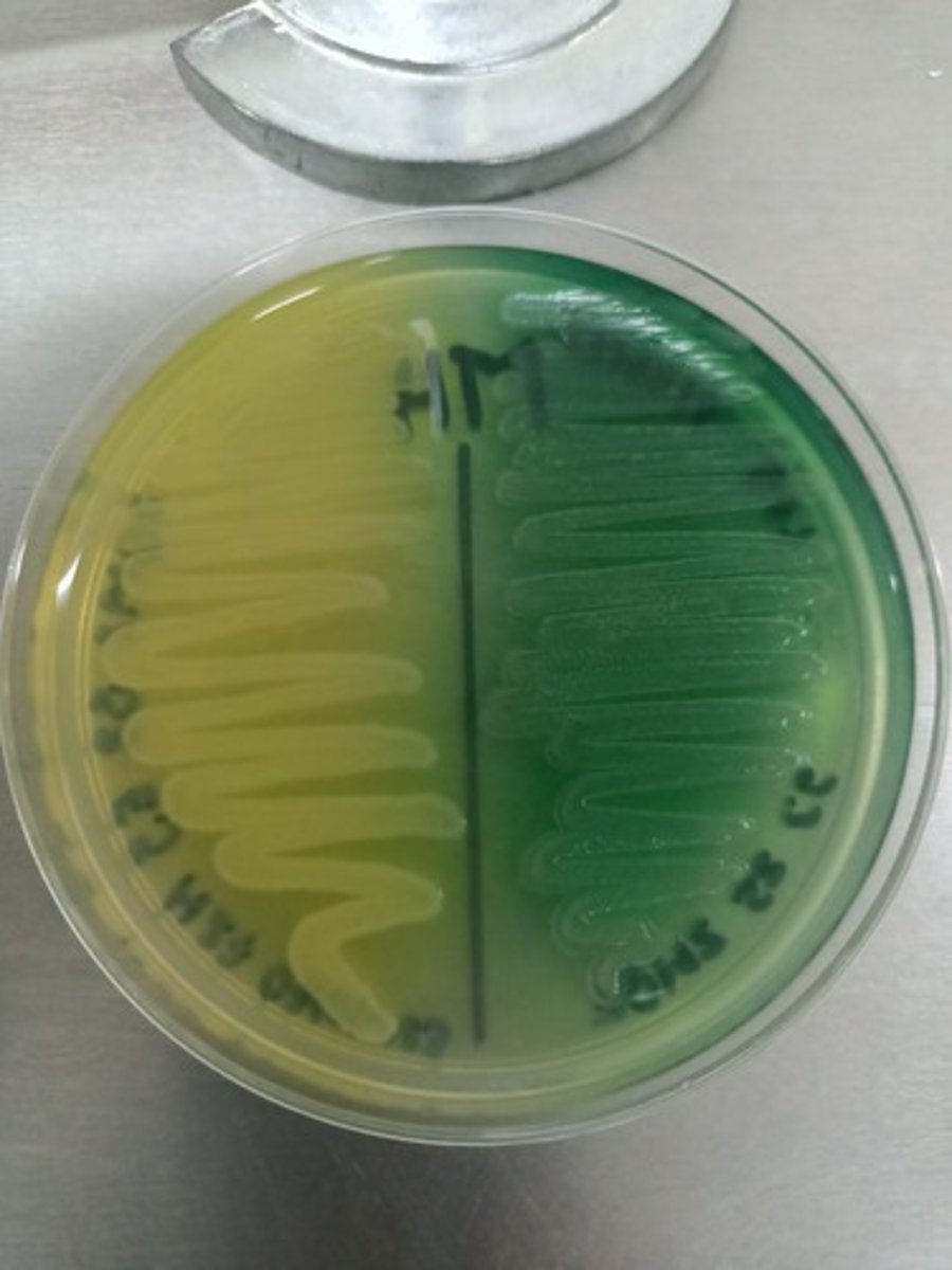 <p>- Pyocianine : bleu/vert</p><p>- Pyoverdine : jaune/vert</p>