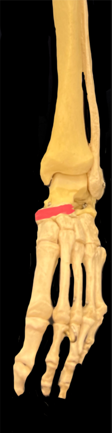 What is highlighted in red?

What muscle inserts here?