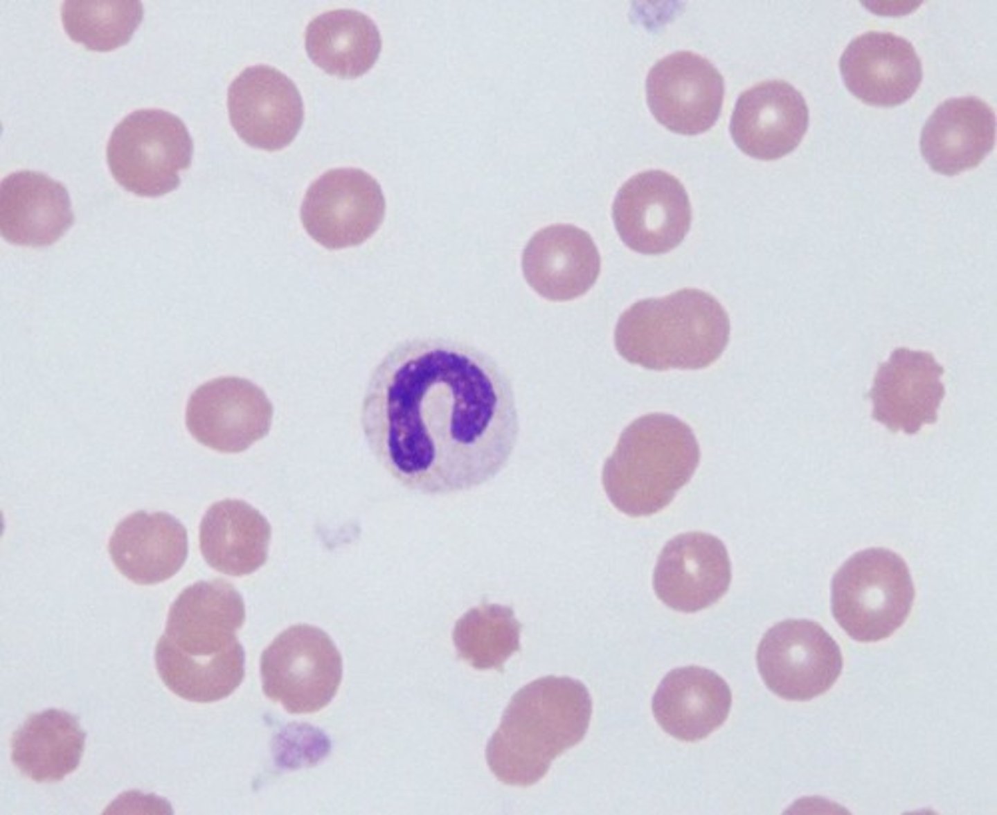 <p>- Indented nucleus >50% w/o filament</p><p>- Coarse, clumped chromatin</p><p>- Pale pink cytoplasm</p><p>- Secondary granules</p><p>- 1:2 N:C ratio</p>