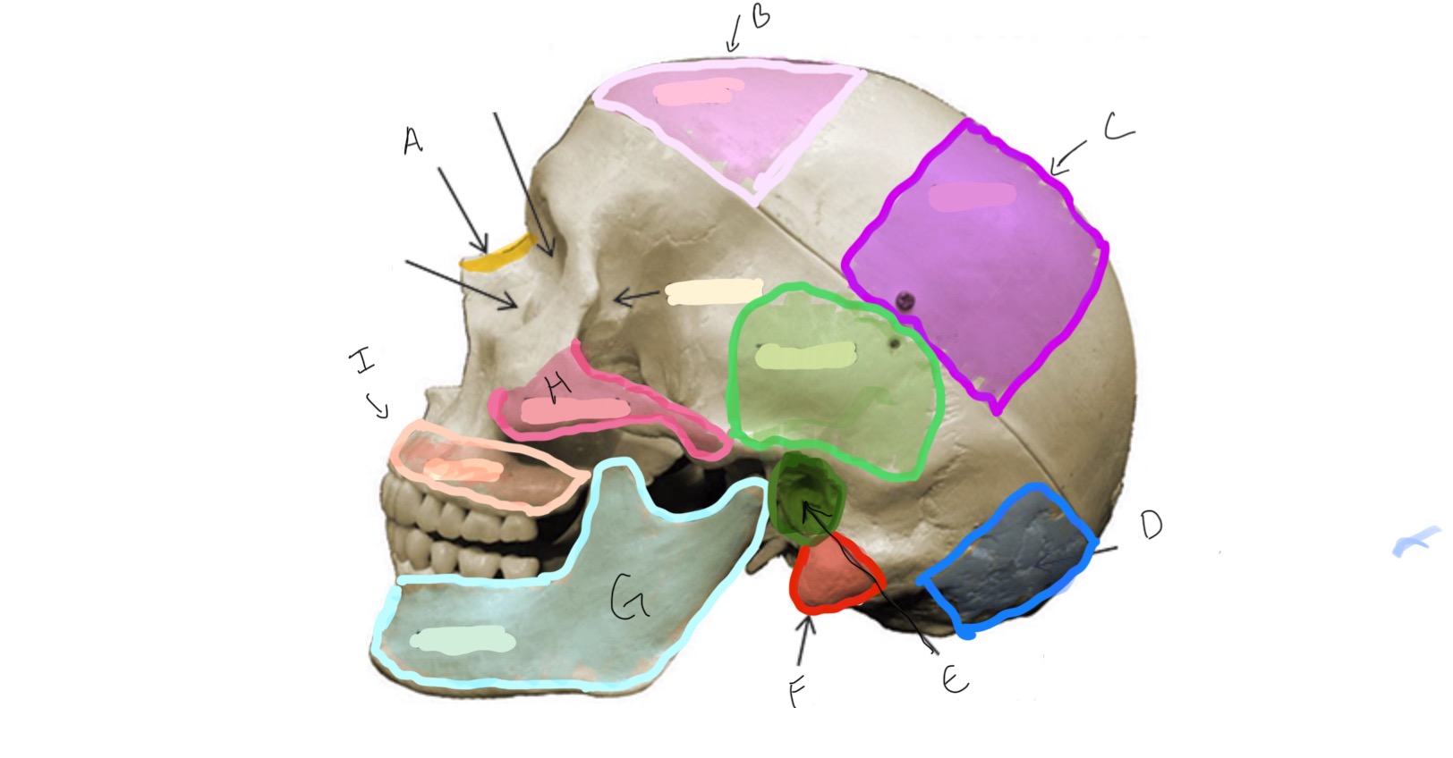 <p>Type of Bone: Skull (lateral)</p><p>What is E?</p>