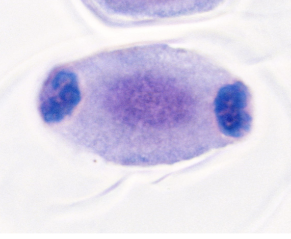 <p>what stage of cell division is this?&nbsp;</p>