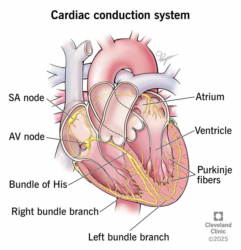 <p><strong>The Pathway of Cardiac Conduction</strong></p><p><span style="color: blue;">SA node (the pacemaker) → atrial myocardium through gap junctions → Atrioventricular (AV) Node - The Gatekeeper → Bundle of His (AV Bundle) → Right and Left Bundle Branches → Purkinje Fibers → Ventricular Myocardium</span></p><p class="ds-markdown-paragraph"><strong>1. Sinoatrial (SA) Node - The Pacemaker</strong></p><ul><li><p class="ds-markdown-paragraph"><strong>Location:</strong> Found in the superior wall of the right atrium, near the entrance of the superior vena cava.</p></li><li><p class="ds-markdown-paragraph"><strong>Function:</strong> This is the <strong>primary pacemaker</strong> of the heart. It spontaneously generates an electrical impulse at a rate of 60-100 times per minute under normal conditions. The impulse from the SA node spreads radially through both atria.</p></li></ul><p class="ds-markdown-paragraph"><strong>2. Atrial Myocardium</strong></p><ul><li><p class="ds-markdown-paragraph"><strong>Conduction:</strong> The electrical wave from the SA node spreads directly through the <strong>gap junctions</strong> between atrial muscle cells. This causes the <strong>atria to contract</strong>, pumping blood through the open atrioventricular (AV) valves into the ventricles.</p></li><li><p class="ds-markdown-paragraph"><strong>Anterior, Middle, and Posterior Internodal Tracts:</strong> While the impulse travels through general atrial muscle, there are also bands of preferential conduction that help speed the impulse toward the AV node.</p></li></ul><p class="ds-markdown-paragraph"><strong>3. Atrioventricular (AV) Node - The Gatekeeper</strong></p><ul><li><p class="ds-markdown-paragraph"><strong>Location:</strong> Situated in the <strong>posteroinferior region of the interatrial septum</strong>, near the coronary sinus.</p></li><li><p class="ds-markdown-paragraph"><strong>Function:</strong> The AV node is the <strong>only electrical connection</strong> between the atria and ventricles (which are otherwise separated by the fibrous cardiac skeleton). Its primary roles are:</p><ul><li><p class="ds-markdown-paragraph">To <strong>delay</strong> the impulse conduction by approximately 0.1 seconds. This delay is crucial as it allows the atria to fully empty their blood into the ventricles before ventricular contraction begins.</p></li><li><p class="ds-markdown-paragraph">To act as a secondary pacemaker (40-60 beats/min) if the SA node fails.</p></li></ul></li></ul><p class="ds-markdown-paragraph"><strong>4. Bundle of His (AV Bundle)</strong></p><ul><li><p class="ds-markdown-paragraph"><strong>Location:</strong> The AV node continues as the Bundle of His, which penetrates through the fibrous skeleton.</p></li><li><p class="ds-markdown-paragraph"><strong>Function:</strong> It is the pathway for the electrical impulse to travel from the atria to the ventricles. It then divides into the right and left bundle branches.</p></li></ul><p class="ds-markdown-paragraph"><strong>5. Right and Left Bundle Branches</strong></p><ul><li><p class="ds-markdown-paragraph"><strong>Location:</strong> These branches run along the right and left sides of the interventricular septum.</p></li><li><p class="ds-markdown-paragraph"><strong>Function:</strong> They conduct the impulse toward the apex (bottom) of the heart. The <strong>Left Bundle Branch</strong> often divides further into <strong>anterior and posterior fascicles</strong>.</p></li></ul><p class="ds-markdown-paragraph"><strong>6. Purkinje Fibers</strong></p><ul><li><p class="ds-markdown-paragraph"><strong>Location:</strong> The bundle branches fan out into a vast network of Purkinje fibers that penetrate the ventricular myocardium.</p></li><li><p class="ds-markdown-paragraph"><strong>Function:</strong> These fibers are <strong>specialized for extremely rapid conduction</strong> (up to 4 m/s). They distribute the wave of excitation from the apex upward through the walls of both ventricles.</p></li></ul><p class="ds-markdown-paragraph"><strong>7. Ventricular Myocardium</strong></p><ul><li><p class="ds-markdown-paragraph"><strong>Conduction:</strong> The impulse spreads from the Purkinje fibers through gap junctions in the ventricular muscle cells. This causes the <strong>ventricles to contract</strong> from the apex toward the base, effectively ejecting blood into the pulmonary artery and aorta.</p></li></ul><div data-type="horizontalRule"><hr></div><p><strong>Summary of the Sequence</strong></p><table style="min-width: 75px;"><colgroup><col style="min-width: 25px;"><col style="min-width: 25px;"><col style="min-width: 25px;"></colgroup><tbody><tr><th colspan="1" rowspan="1" style="border-bottom: 1.06667px solid rgba(0, 0, 0, 0.12); font: 500 15px / 25px quote-cjk-patch, Inter, system-ui, -apple-system, BlinkMacSystemFont, &quot;Segoe UI&quot;, Roboto, Oxygen, Ubuntu, Cantarell, &quot;Open Sans&quot;, &quot;Helvetica Neue&quot;, sans-serif; border-top: none; padding: 10px 16px 10px 0px; text-align: left;"><p><strong>Step</strong></p></th><th colspan="1" rowspan="1" style="border-bottom: 1.06667px solid rgba(0, 0, 0, 0.12); font: 500 15px / 25px quote-cjk-patch, Inter, system-ui, -apple-system, BlinkMacSystemFont, &quot;Segoe UI&quot;, Roboto, Oxygen, Ubuntu, Cantarell, &quot;Open Sans&quot;, &quot;Helvetica Neue&quot;, sans-serif; border-top: none; padding: 10px 16px; text-align: left;"><p><strong>Structure</strong></p></th><th colspan="1" rowspan="1" style="border-bottom: 1.06667px solid rgba(0, 0, 0, 0.12); font: 500 15px / 25px quote-cjk-patch, Inter, system-ui, -apple-system, BlinkMacSystemFont, &quot;Segoe UI&quot;, Roboto, Oxygen, Ubuntu, Cantarell, &quot;Open Sans&quot;, &quot;Helvetica Neue&quot;, sans-serif; border-top: none; padding: 10px 16px; text-align: left;"><p><strong>Action</strong></p></th></tr><tr><td colspan="1" rowspan="1" style="border-bottom: 1.06667px solid rgba(0, 0, 0, 0.1); font: 400 15px / 25px quote-cjk-patch, Inter, system-ui, -apple-system, BlinkMacSystemFont, &quot;Segoe UI&quot;, Roboto, Oxygen, Ubuntu, Cantarell, &quot;Open Sans&quot;, &quot;Helvetica Neue&quot;, sans-serif; min-width: 100px; max-width: max(30vw, 320px); padding: 10px 16px 10px 0px;"><p><strong>1</strong></p></td><td colspan="1" rowspan="1" style="border-bottom: 1.06667px solid rgba(0, 0, 0, 0.1); font: 400 15px / 25px quote-cjk-patch, Inter, system-ui, -apple-system, BlinkMacSystemFont, &quot;Segoe UI&quot;, Roboto, Oxygen, Ubuntu, Cantarell, &quot;Open Sans&quot;, &quot;Helvetica Neue&quot;, sans-serif; min-width: 100px; max-width: max(30vw, 320px); padding: 10px 16px;"><p><strong>Sinoatrial (SA) Node</strong></p></td><td colspan="1" rowspan="1" style="border-bottom: 1.06667px solid rgba(0, 0, 0, 0.1); font: 400 15px / 25px quote-cjk-patch, Inter, system-ui, -apple-system, BlinkMacSystemFont, &quot;Segoe UI&quot;, Roboto, Oxygen, Ubuntu, Cantarell, &quot;Open Sans&quot;, &quot;Helvetica Neue&quot;, sans-serif; min-width: 100px; max-width: max(30vw, 320px); padding: 10px 16px;"><p><strong>Impulse initiation.</strong> Pacemaker cells fire.</p></td></tr><tr><td colspan="1" rowspan="1" style="border-bottom: 1.06667px solid rgba(0, 0, 0, 0.1); font: 400 15px / 25px quote-cjk-patch, Inter, system-ui, -apple-system, BlinkMacSystemFont, &quot;Segoe UI&quot;, Roboto, Oxygen, Ubuntu, Cantarell, &quot;Open Sans&quot;, &quot;Helvetica Neue&quot;, sans-serif; min-width: 100px; max-width: max(30vw, 320px); padding: 10px 16px 10px 0px;"><p><strong>2</strong></p></td><td colspan="1" rowspan="1" style="border-bottom: 1.06667px solid rgba(0, 0, 0, 0.1); font: 400 15px / 25px quote-cjk-patch, Inter, system-ui, -apple-system, BlinkMacSystemFont, &quot;Segoe UI&quot;, Roboto, Oxygen, Ubuntu, Cantarell, &quot;Open Sans&quot;, &quot;Helvetica Neue&quot;, sans-serif; min-width: 100px; max-width: max(30vw, 320px); padding: 10px 16px;"><p><strong>Atria</strong></p></td><td colspan="1" rowspan="1" style="border-bottom: 1.06667px solid rgba(0, 0, 0, 0.1); font: 400 15px / 25px quote-cjk-patch, Inter, system-ui, -apple-system, BlinkMacSystemFont, &quot;Segoe UI&quot;, Roboto, Oxygen, Ubuntu, Cantarell, &quot;Open Sans&quot;, &quot;Helvetica Neue&quot;, sans-serif; min-width: 100px; max-width: max(30vw, 320px); padding: 10px 16px;"><p>Impulse spreads, causing <strong>atrial contraction</strong>.</p></td></tr><tr><td colspan="1" rowspan="1" style="border-bottom: 1.06667px solid rgba(0, 0, 0, 0.1); font: 400 15px / 25px quote-cjk-patch, Inter, system-ui, -apple-system, BlinkMacSystemFont, &quot;Segoe UI&quot;, Roboto, Oxygen, Ubuntu, Cantarell, &quot;Open Sans&quot;, &quot;Helvetica Neue&quot;, sans-serif; min-width: 100px; max-width: max(30vw, 320px); padding: 10px 16px 10px 0px;"><p><strong>3</strong></p></td><td colspan="1" rowspan="1" style="border-bottom: 1.06667px solid rgba(0, 0, 0, 0.1); font: 400 15px / 25px quote-cjk-patch, Inter, system-ui, -apple-system, BlinkMacSystemFont, &quot;Segoe UI&quot;, Roboto, Oxygen, Ubuntu, Cantarell, &quot;Open Sans&quot;, &quot;Helvetica Neue&quot;, sans-serif; min-width: 100px; max-width: max(30vw, 320px); padding: 10px 16px;"><p><strong>Atrioventricular (AV) Node</strong></p></td><td colspan="1" rowspan="1" style="border-bottom: 1.06667px solid rgba(0, 0, 0, 0.1); font: 400 15px / 25px quote-cjk-patch, Inter, system-ui, -apple-system, BlinkMacSystemFont, &quot;Segoe UI&quot;, Roboto, Oxygen, Ubuntu, Cantarell, &quot;Open Sans&quot;, &quot;Helvetica Neue&quot;, sans-serif; min-width: 100px; max-width: max(30vw, 320px); padding: 10px 16px;"><p>Impulse is <strong>delayed</strong> to allow ventricles to fill.</p></td></tr><tr><td colspan="1" rowspan="1" style="border-bottom: 1.06667px solid rgba(0, 0, 0, 0.1); font: 400 15px / 25px quote-cjk-patch, Inter, system-ui, -apple-system, BlinkMacSystemFont, &quot;Segoe UI&quot;, Roboto, Oxygen, Ubuntu, Cantarell, &quot;Open Sans&quot;, &quot;Helvetica Neue&quot;, sans-serif; min-width: 100px; max-width: max(30vw, 320px); padding: 10px 16px 10px 0px;"><p><strong>4</strong></p></td><td colspan="1" rowspan="1" style="border-bottom: 1.06667px solid rgba(0, 0, 0, 0.1); font: 400 15px / 25px quote-cjk-patch, Inter, system-ui, -apple-system, BlinkMacSystemFont, &quot;Segoe UI&quot;, Roboto, Oxygen, Ubuntu, Cantarell, &quot;Open Sans&quot;, &quot;Helvetica Neue&quot;, sans-serif; min-width: 100px; max-width: max(30vw, 320px); padding: 10px 16px;"><p><strong>Bundle of His</strong></p></td><td colspan="1" rowspan="1" style="border-bottom: 1.06667px solid rgba(0, 0, 0, 0.1); font: 400 15px / 25px quote-cjk-patch, Inter, system-ui, -apple-system, BlinkMacSystemFont, &quot;Segoe UI&quot;, Roboto, Oxygen, Ubuntu, Cantarell, &quot;Open Sans&quot;, &quot;Helvetica Neue&quot;, sans-serif; min-width: 100px; max-width: max(30vw, 320px); padding: 10px 16px;"><p>Impulse travels to the interventricular septum.</p></td></tr><tr><td colspan="1" rowspan="1" style="border-bottom: 1.06667px solid rgba(0, 0, 0, 0.1); font: 400 15px / 25px quote-cjk-patch, Inter, system-ui, -apple-system, BlinkMacSystemFont, &quot;Segoe UI&quot;, Roboto, Oxygen, Ubuntu, Cantarell, &quot;Open Sans&quot;, &quot;Helvetica Neue&quot;, sans-serif; min-width: 100px; max-width: max(30vw, 320px); padding: 10px 16px 10px 0px;"><p><strong>5</strong></p></td><td colspan="1" rowspan="1" style="border-bottom: 1.06667px solid rgba(0, 0, 0, 0.1); font: 400 15px / 25px quote-cjk-patch, Inter, system-ui, -apple-system, BlinkMacSystemFont, &quot;Segoe UI&quot;, Roboto, Oxygen, Ubuntu, Cantarell, &quot;Open Sans&quot;, &quot;Helvetica Neue&quot;, sans-serif; min-width: 100px; max-width: max(30vw, 320px); padding: 10px 16px;"><p><strong>Right &amp; Left Bundle Branches</strong></p></td><td colspan="1" rowspan="1" style="border-bottom: 1.06667px solid rgba(0, 0, 0, 0.1); font: 400 15px / 25px quote-cjk-patch, Inter, system-ui, -apple-system, BlinkMacSystemFont, &quot;Segoe UI&quot;, Roboto, Oxygen, Ubuntu, Cantarell, &quot;Open Sans&quot;, &quot;Helvetica Neue&quot;, sans-serif; min-width: 100px; max-width: max(30vw, 320px); padding: 10px 16px;"><p>Impulse travels down the septum toward the apex.</p></td></tr><tr><td colspan="1" rowspan="1" style="border-bottom: 1.06667px solid rgba(0, 0, 0, 0.1); font: 400 15px / 25px quote-cjk-patch, Inter, system-ui, -apple-system, BlinkMacSystemFont, &quot;Segoe UI&quot;, Roboto, Oxygen, Ubuntu, Cantarell, &quot;Open Sans&quot;, &quot;Helvetica Neue&quot;, sans-serif; min-width: 100px; max-width: max(30vw, 320px); padding: 10px 16px 10px 0px;"><p><strong>6</strong></p></td><td colspan="1" rowspan="1" style="border-bottom: 1.06667px solid rgba(0, 0, 0, 0.1); font: 400 15px / 25px quote-cjk-patch, Inter, system-ui, -apple-system, BlinkMacSystemFont, &quot;Segoe UI&quot;, Roboto, Oxygen, Ubuntu, Cantarell, &quot;Open Sans&quot;, &quot;Helvetica Neue&quot;, sans-serif; min-width: 100px; max-width: max(30vw, 320px); padding: 10px 16px;"><p><strong>Purkinje Fiber Network</strong></p></td><td colspan="1" rowspan="1" style="border-bottom: 1.06667px solid rgba(0, 0, 0, 0.1); font: 400 15px / 25px quote-cjk-patch, Inter, system-ui, -apple-system, BlinkMacSystemFont, &quot;Segoe UI&quot;, Roboto, Oxygen, Ubuntu, Cantarell, &quot;Open Sans&quot;, &quot;Helvetica Neue&quot;, sans-serif; min-width: 100px; max-width: max(30vw, 320px); padding: 10px 16px;"><p>Impulse rapidly spreads throughout ventricular walls.</p></td></tr><tr><td colspan="1" rowspan="1" style="border-bottom: 1.06667px solid rgba(0, 0, 0, 0.1); font: 400 15px / 25px quote-cjk-patch, Inter, system-ui, -apple-system, BlinkMacSystemFont, &quot;Segoe UI&quot;, Roboto, Oxygen, Ubuntu, Cantarell, &quot;Open Sans&quot;, &quot;Helvetica Neue&quot;, sans-serif; min-width: 100px; max-width: max(30vw, 320px); padding: 10px 16px 10px 0px;"><p><strong>7</strong></p></td><td colspan="1" rowspan="1" style="border-bottom: 1.06667px solid rgba(0, 0, 0, 0.1); font: 400 15px / 25px quote-cjk-patch, Inter, system-ui, -apple-system, BlinkMacSystemFont, &quot;Segoe UI&quot;, Roboto, Oxygen, Ubuntu, Cantarell, &quot;Open Sans&quot;, &quot;Helvetica Neue&quot;, sans-serif; min-width: 100px; max-width: max(30vw, 320px); padding: 10px 16px;"><p><strong>Ventricles</strong></p></td><td colspan="1" rowspan="1" style="border-bottom: 1.06667px solid rgba(0, 0, 0, 0.1); font: 400 15px / 25px quote-cjk-patch, Inter, system-ui, -apple-system, BlinkMacSystemFont, &quot;Segoe UI&quot;, Roboto, Oxygen, Ubuntu, Cantarell, &quot;Open Sans&quot;, &quot;Helvetica Neue&quot;, sans-serif; min-width: 100px; max-width: max(30vw, 320px); padding: 10px 16px;"><p><strong>Ventricular contraction</strong> from apex upward.</p></td></tr></tbody></table><p class="ds-markdown-paragraph">This highly coordinated pathway ensures efficient pumping: the atria contract first to top off the ventricular volume, and a fraction of a second later, the powerful ventric</p>