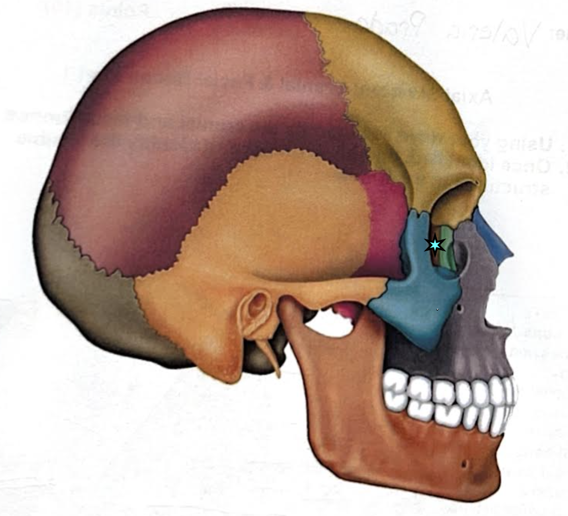 term image
