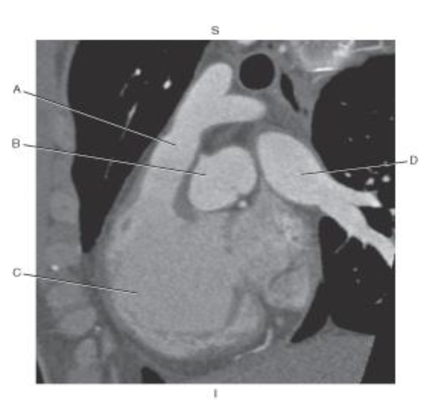 <p>Which line points to the<mark data-color="blue"> root of the aorta?</mark></p>