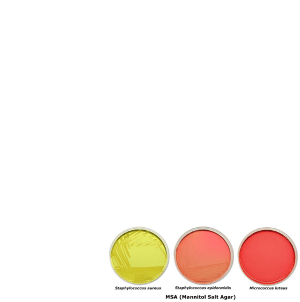 <p>-pus/surface swab, blood, sputum</p><p>-grows on blood agar, inoculation onto Mannitol Salt agar (MSA)</p><p>-MSA contains 7.5% NaCl which inhibits growth of other normal flora</p><p>-Catalase + differentiates from <em>Streptococcus (catalase -)</em></p><p>-Coagulase + differentiates more virulent <em>S. aureus </em>from other species</p><p>-Microdilution / Disk Diffusion susceptibility tests should be done</p>