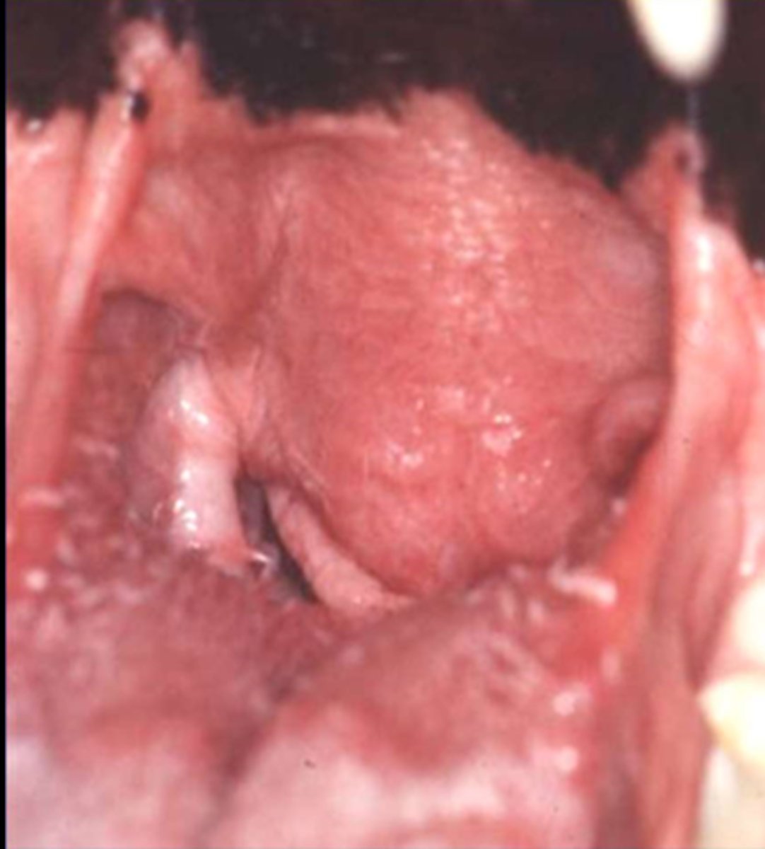 <p>Identify the pathology?</p>