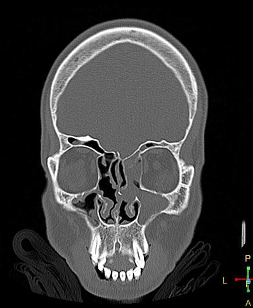 <p>Concerns/complications?</p>