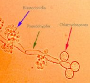 <p>both = asexual reproduction of <strong><mark data-color="#fffbc9" style="background-color: rgb(255, 251, 201); color: inherit;">YEAST</mark></strong></p><p><strong><u>Blastoconidia</u> </strong>=</p><ul><li><p>spores produced by <span style="color: rgb(0, 147, 233);"><strong>budding</strong></span></p></li><li><p>develop in <strong>clusters</strong> along hyphae</p></li></ul><p><strong><u>Chlamydoconidia</u> </strong>=</p><ul><li><p>thick-walled <strong>survival spores</strong> forming under certain growth conditions</p></li><li><p><span style="color: blue;"><strong>Terminal</strong></span><strong>, </strong><span style="color: purple;"><strong>Sessile</strong></span><strong>, </strong><span style="color: green;"><strong>Intercalary</strong> </span>chlamydospores form at <span style="color: blue;">tips</span>, <span style="color: purple;">side</span>, or <span style="color: green;">inside </span>hyphae</p></li></ul><p></p>