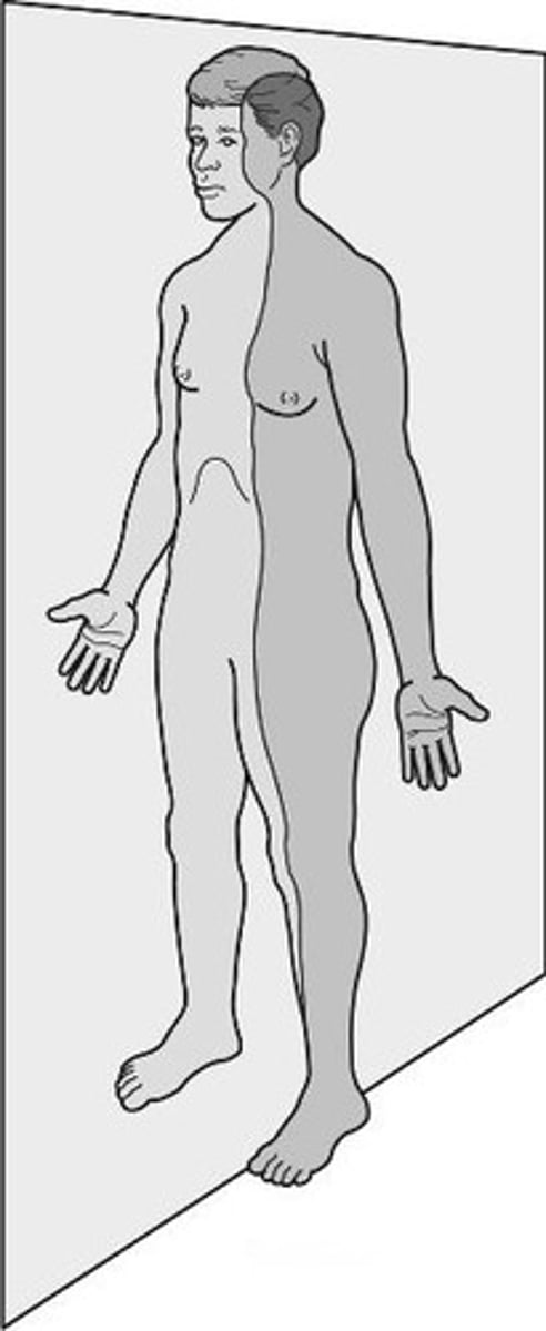 <p>vertical plane that divides the body or organ into right and left sides</p>