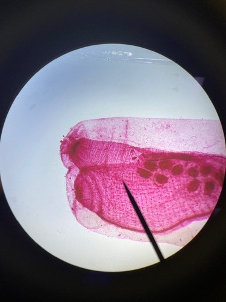 <p>What Phylum is this organism?</p>