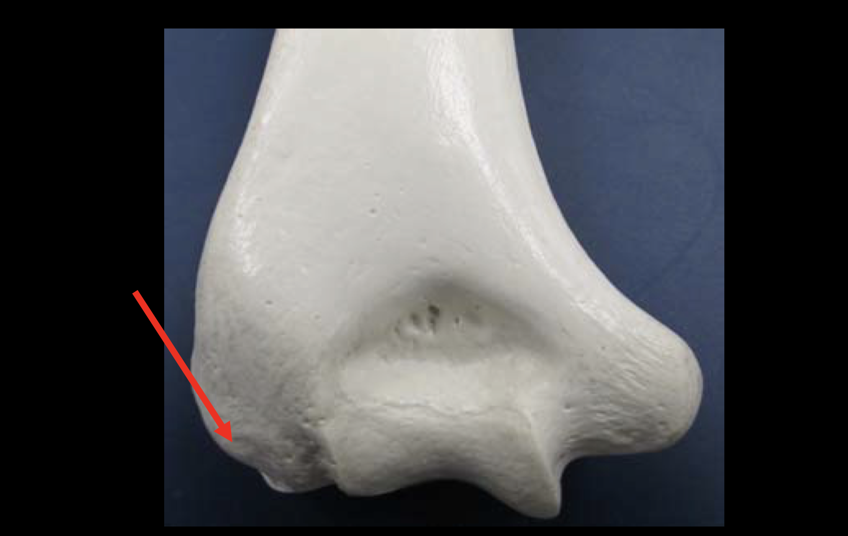 <p>Name this region of the humerus</p>