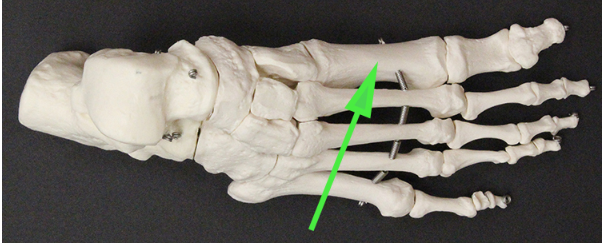 <p>Name the bone indicated by the green arrow.</p>