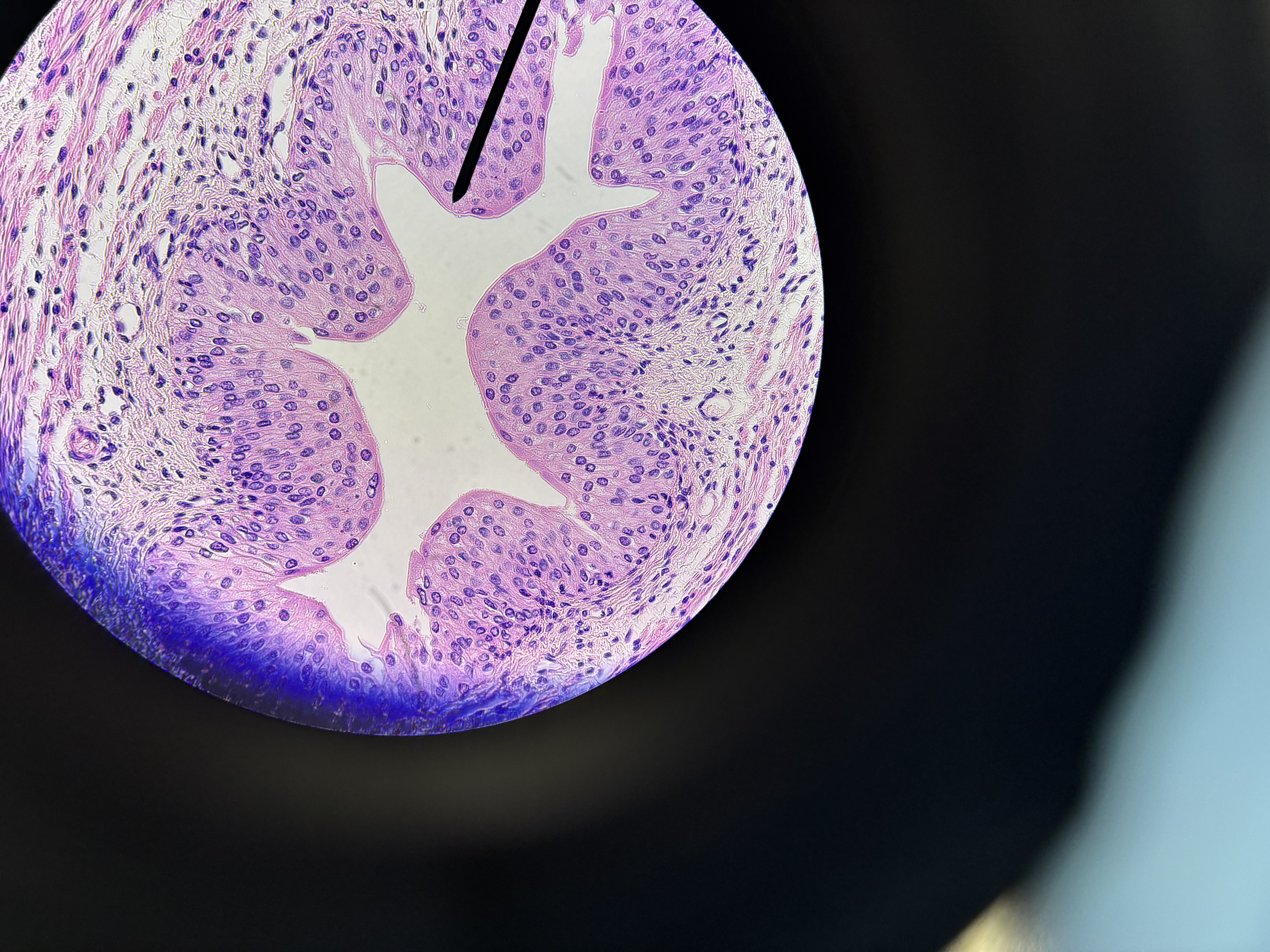 <p>Transitional epithelium</p>