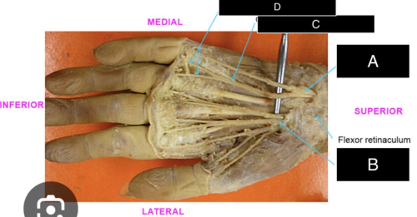 <p>ID nerve C</p>