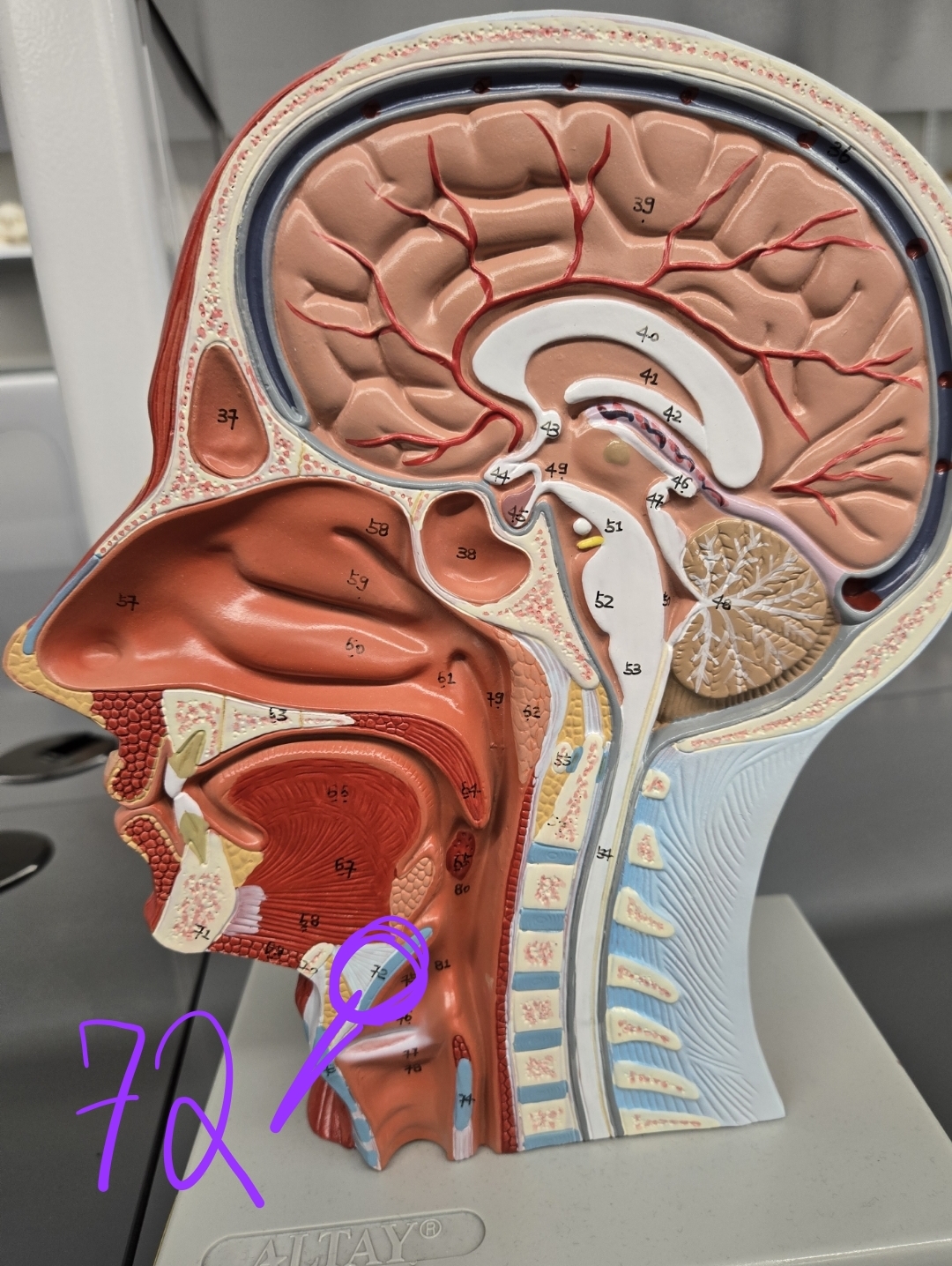 <p>Half head model: what structure is this?</p>
