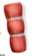 <p>Name this fascicle arrangement:</p>