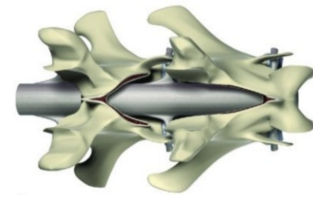 <p>Ventral slot for disc decompression +/- stabilisation <span data-name="black_small_square" data-type="emoji">▪</span> &gt;&gt; Dorsal laminectomy to address osseous compression +/- stabilisation</p>