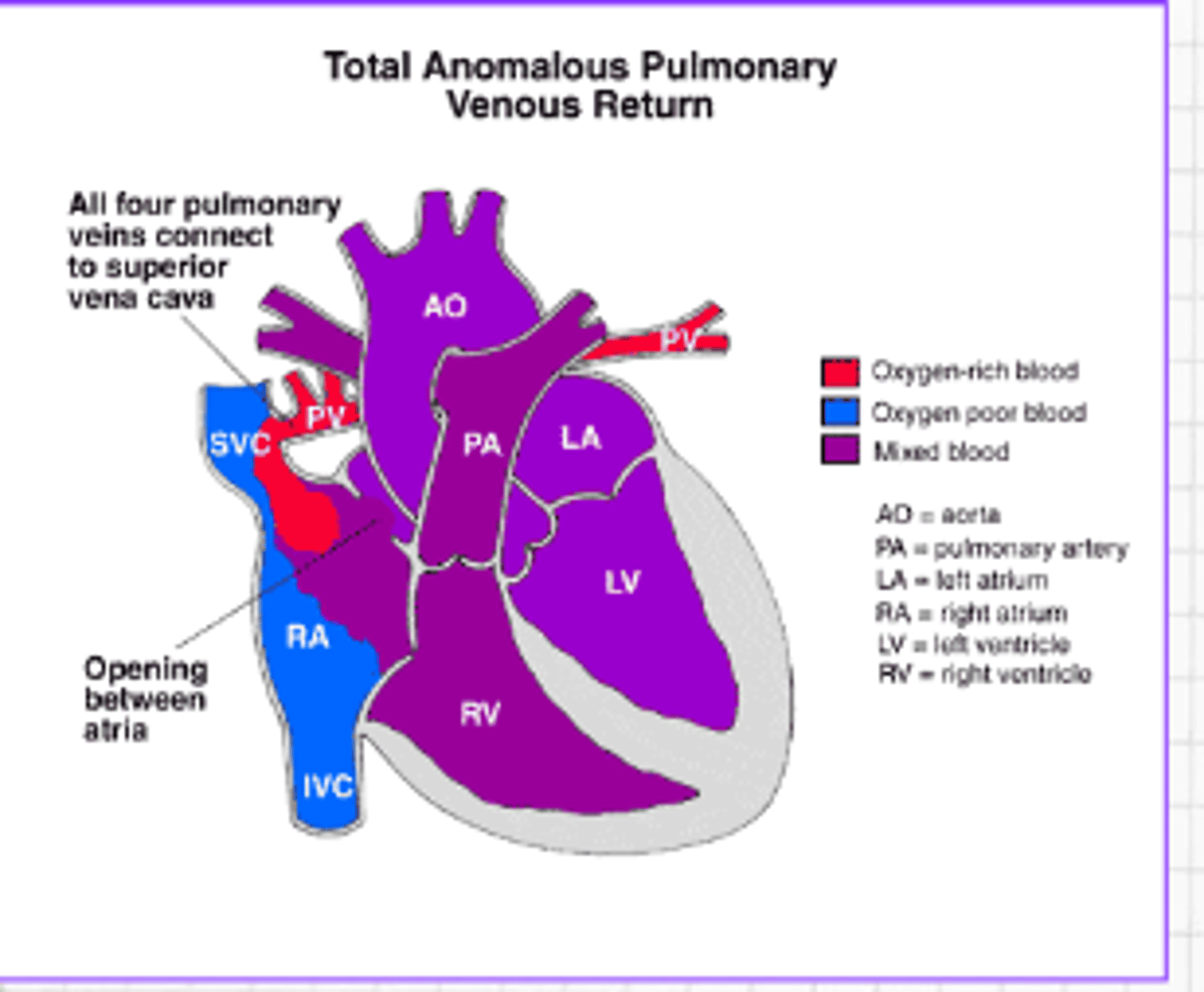<p>Oxygen-rich blood does not return from the lungs to the left atrium or to a vein flowing to the right atrium or SVC. Instead, the oxygen-rich blood returns to the right side of the heart via the superior vena cava at the right atrium. Thus, oxygen-rich blood mixes with oxygen-poor blood.</p>