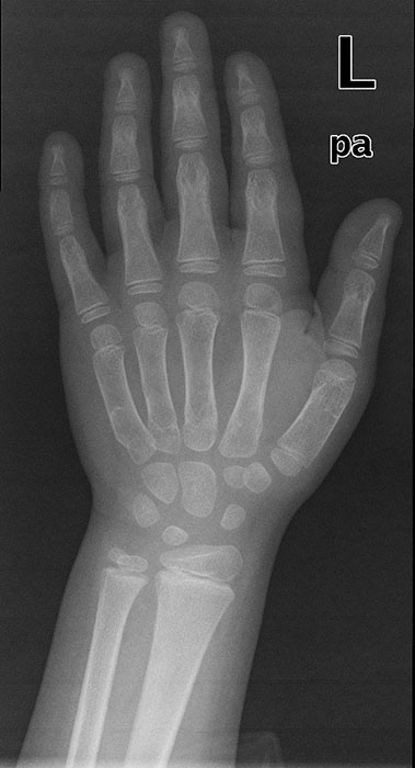 <p>This patient is 5 years old. What pathology do the have.</p>