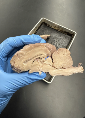 <p>what gland is this?</p>