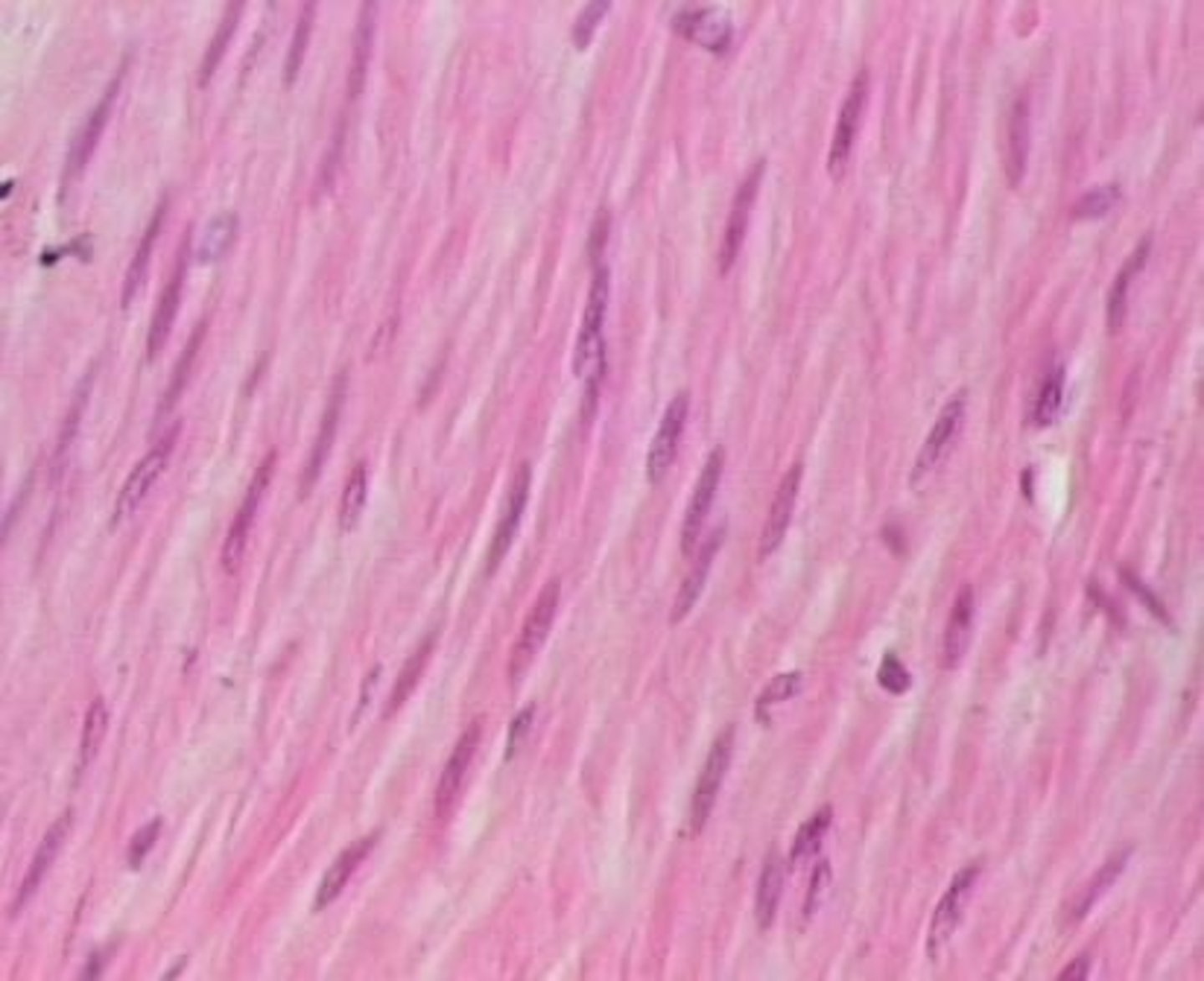 <p>what tissue is this? *hint: has a lot of nuclei and a cigar appearance (tapers at the end)*</p>