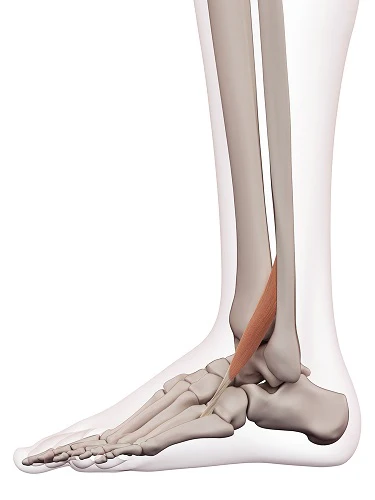 <p>What muscle is this?</p>