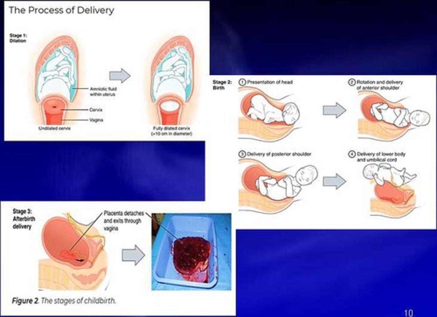 <p>Delivery of placenta and fetal membranes.</p>