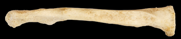 <p>Name this bone.</p><p>Left side or right side?</p><p>(Anterior view).</p>