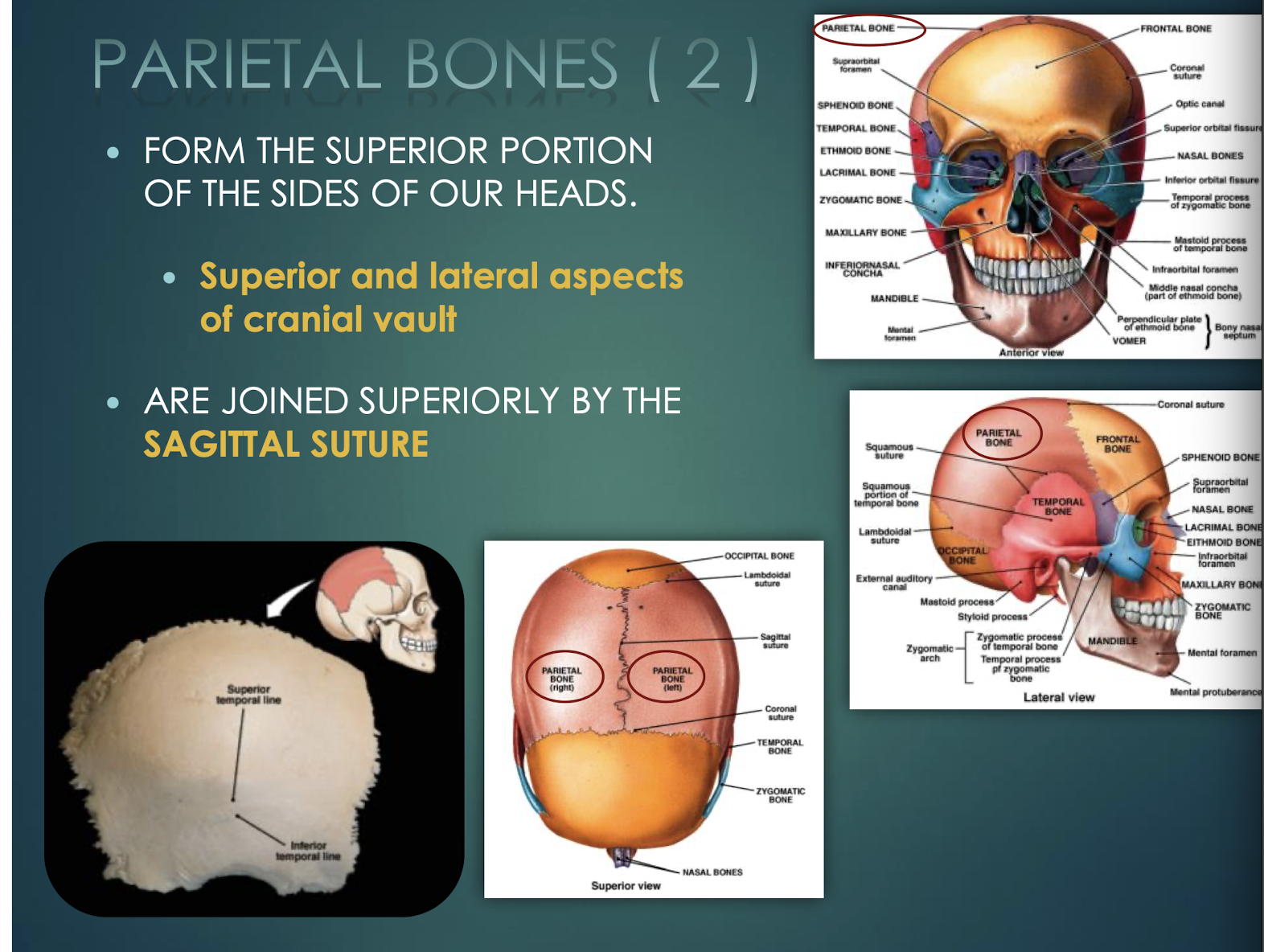 <p>Parietal Bones</p>