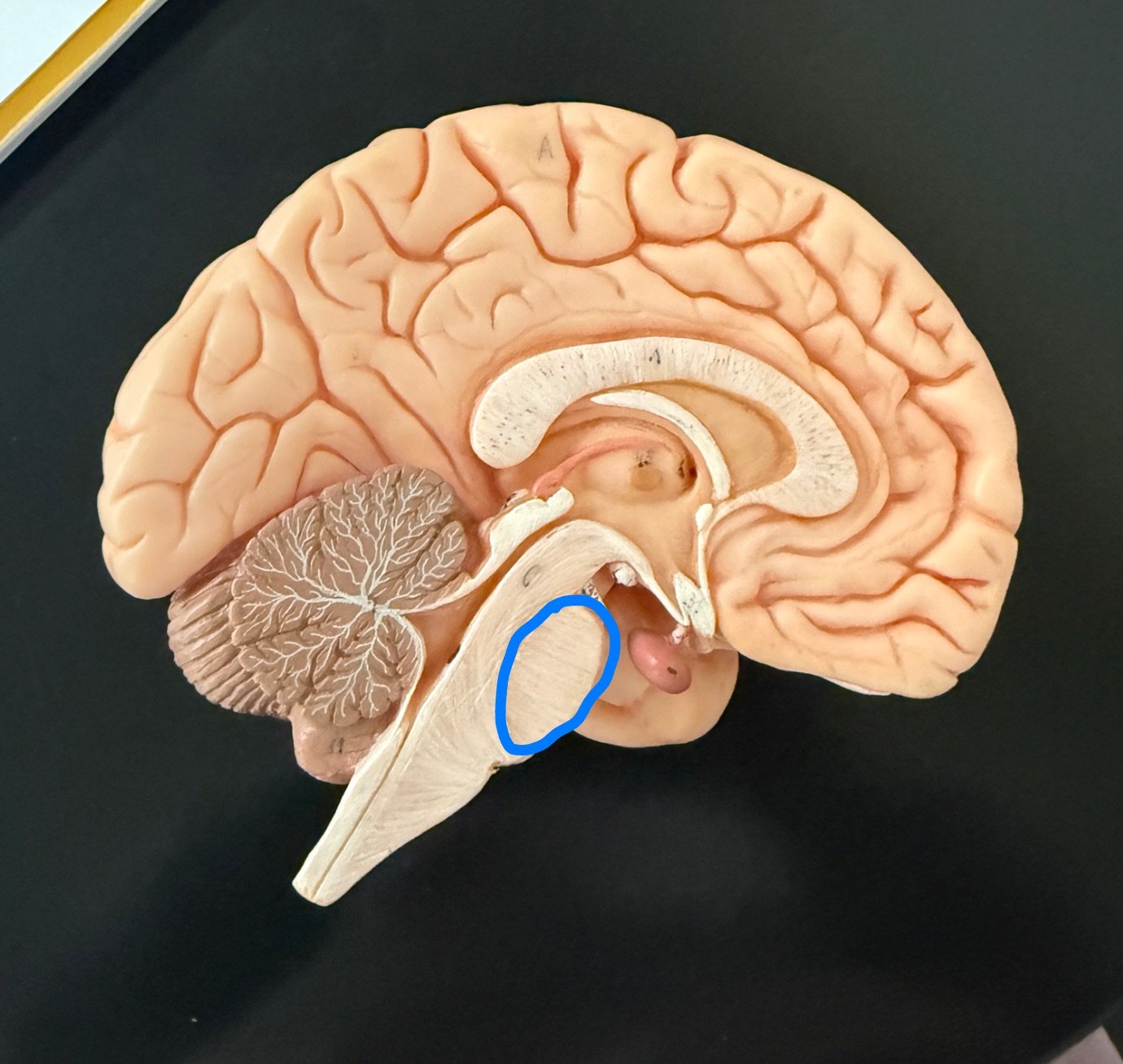 <p>What is outlined in blue on the brain model?</p>