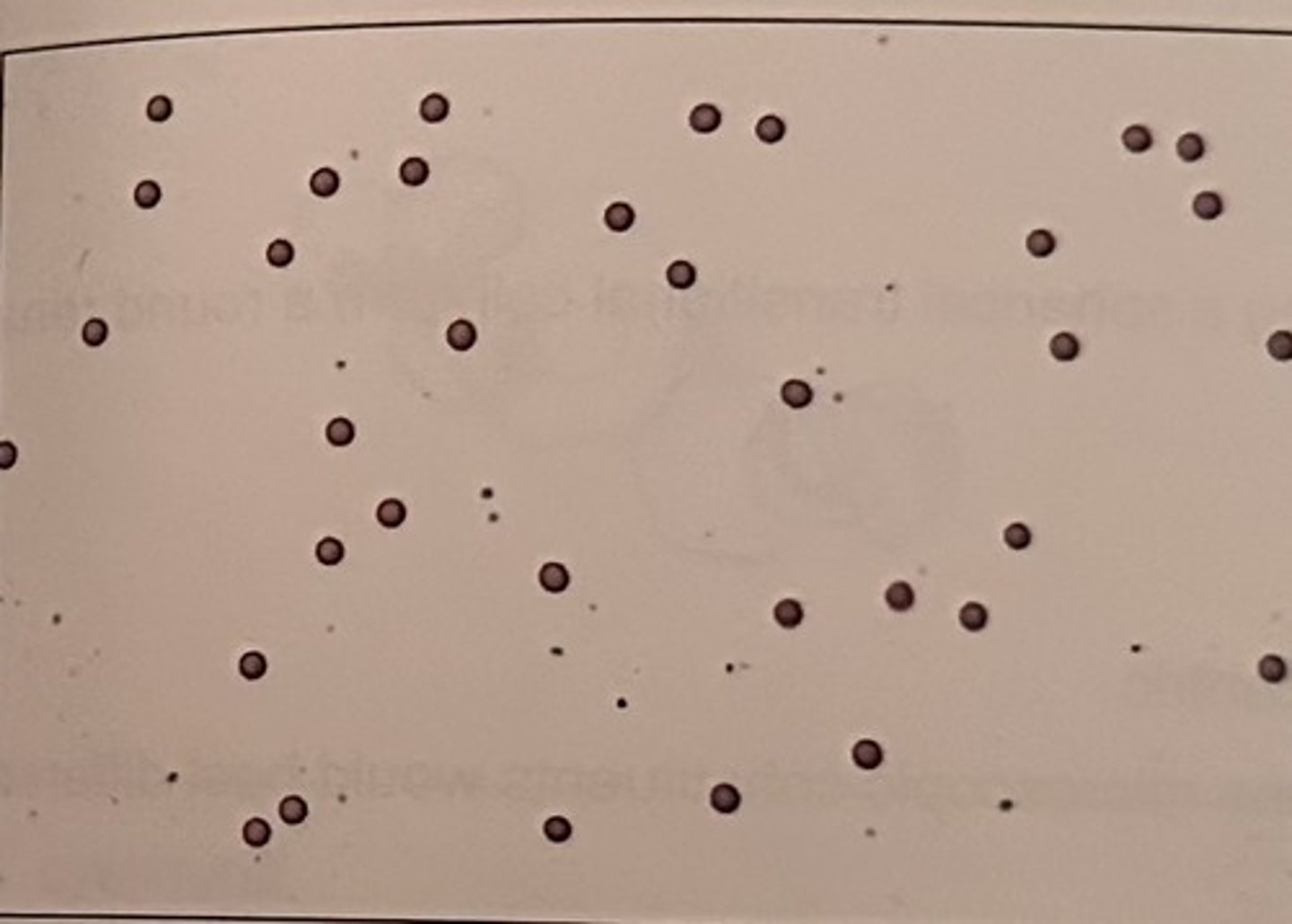 <p>a. RBC</p>